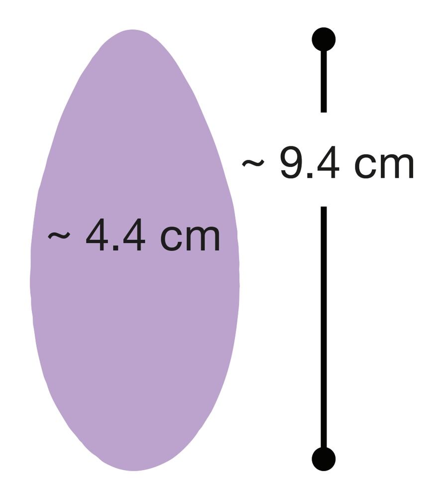 Auflegevibrator mit Fernbedienung